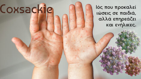 Coxsackie