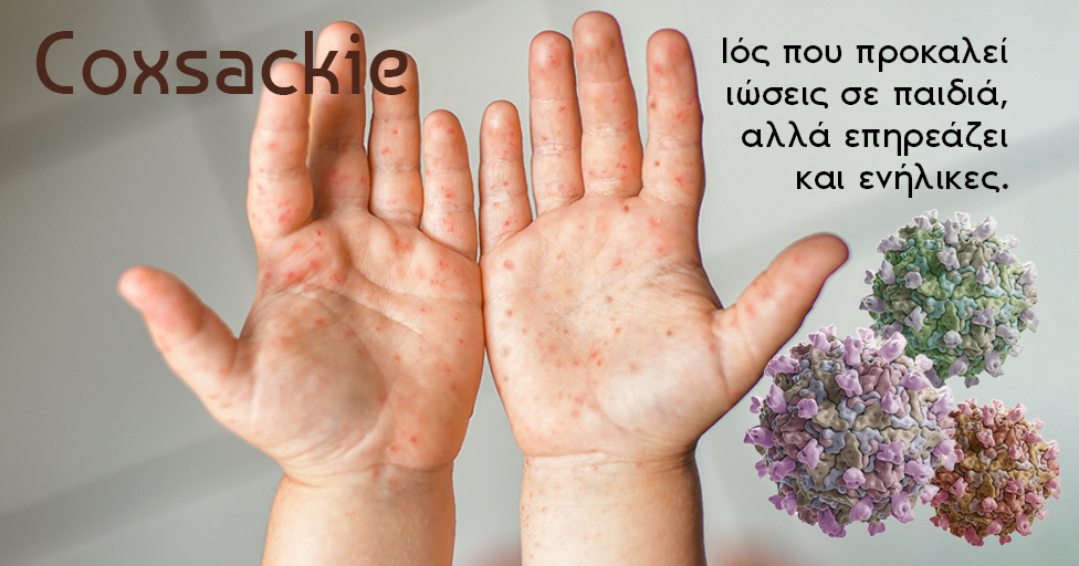 Coxsackie